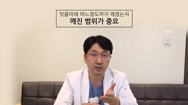 치아 부러짐, 파절엔 임플란트가 답? 관련 이미지 27