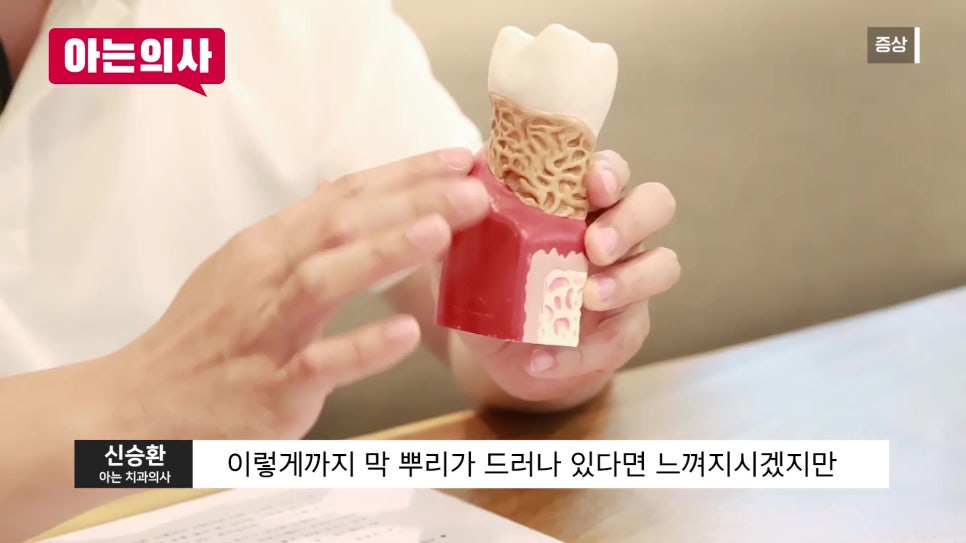 가락시장역치과 - 잇몸병, 흔들릴 때는 이미 늦었다?! 관련 이미지 5