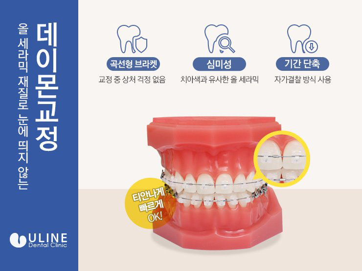 종합운동장역치과 정확한 결과가 중요하죠 관련 이미지 7