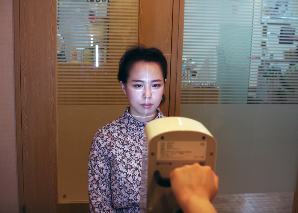 아랫니부분교정 빠른 결과를 보여주는 관련 이미지 7