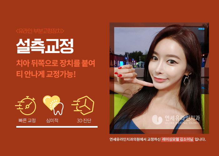 치아부분교정 비용 꼼꼼히 따져보셔야죠 관련 이미지 5