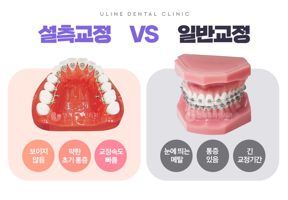 방배동치과 미소천사가 되어버렸어 관련 이미지 3
