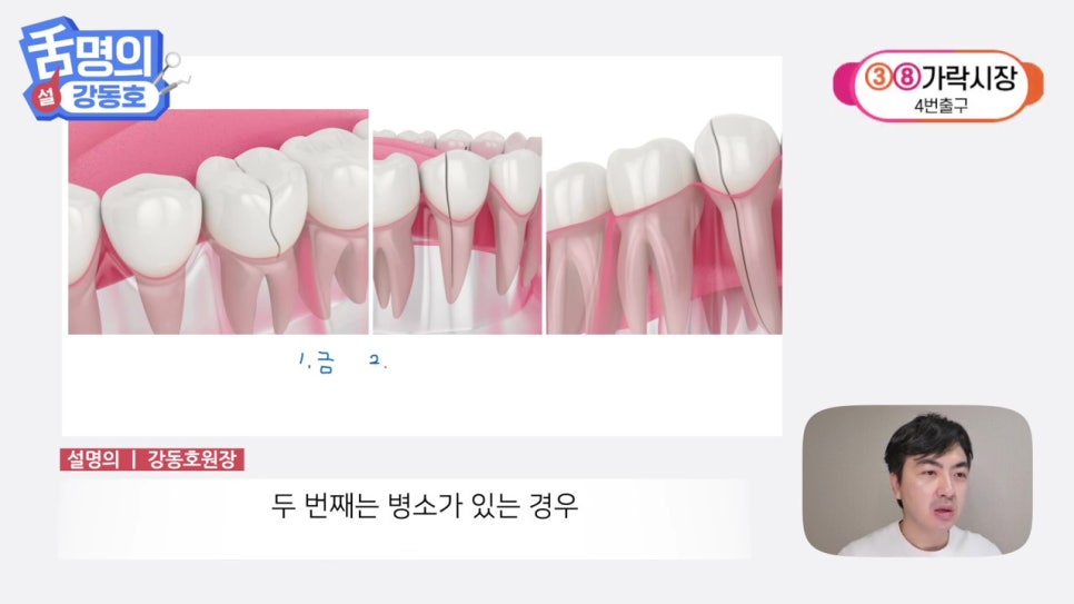 역삼역야간진료치과, 씹을 때마다 아파? 관련 이미지 8