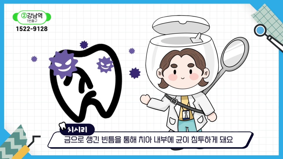 신림역치과 - 치아 균열은 자연 회복되지 않아 관련 이미지 4
