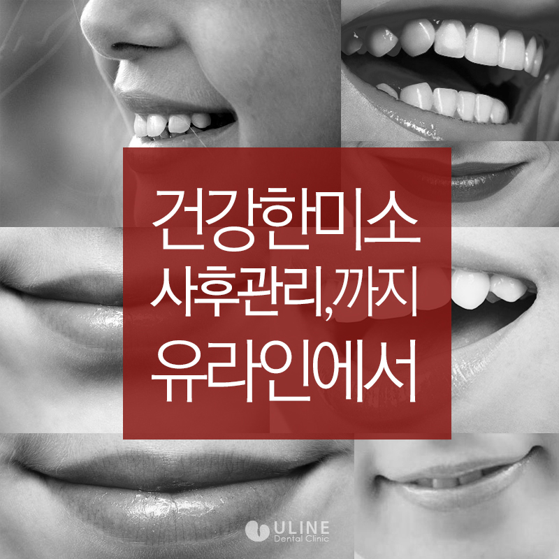 앞니임플란트가격 결과 모두 좋아 관련 이미지 5