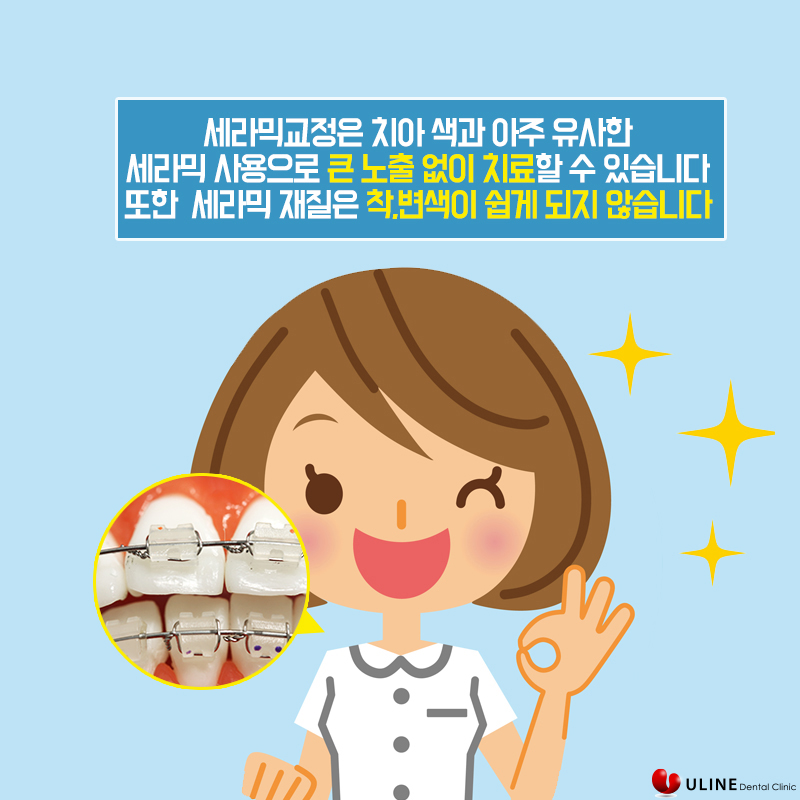 성인치아교정 고민하고계신가요? 관련 이미지 4
