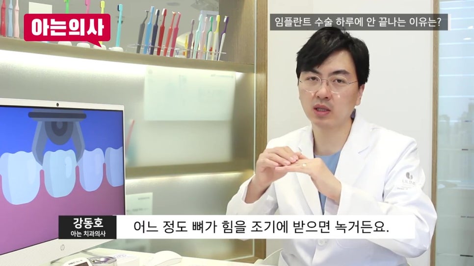 당일임플란트, 위험성 알아야 관련 이미지 14
