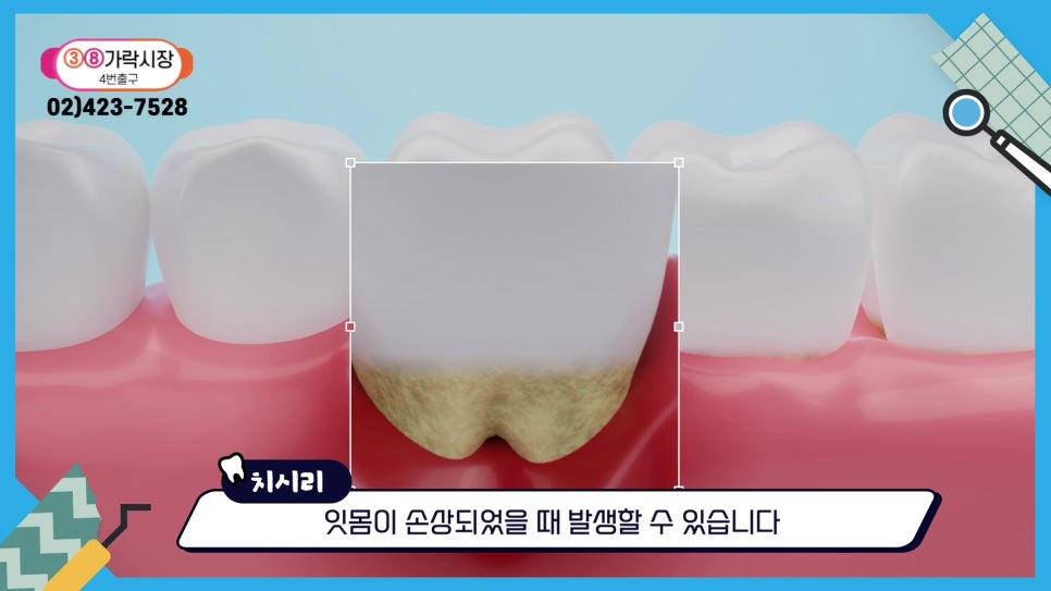 Gum Health During Orthodontic Treatment in Sillim-dong.. image 22