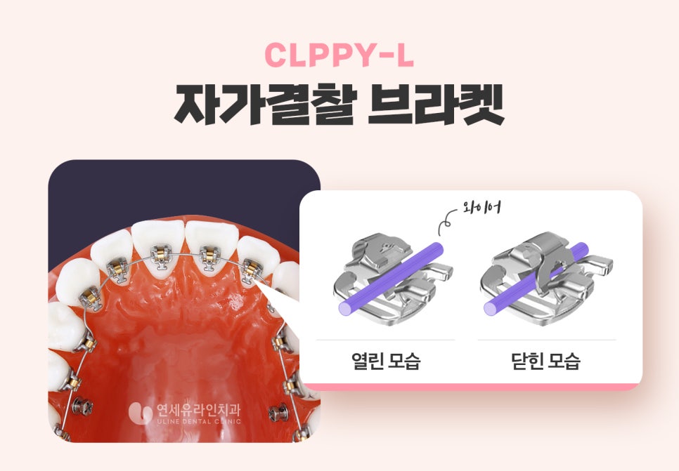방배동치과 미소천사가 되어버렸어 관련 이미지 5