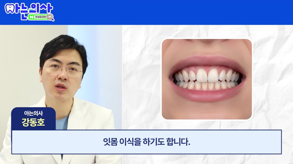 관악구 신림동치과 - 치아가 길어보이는 이유 관련 이미지 22