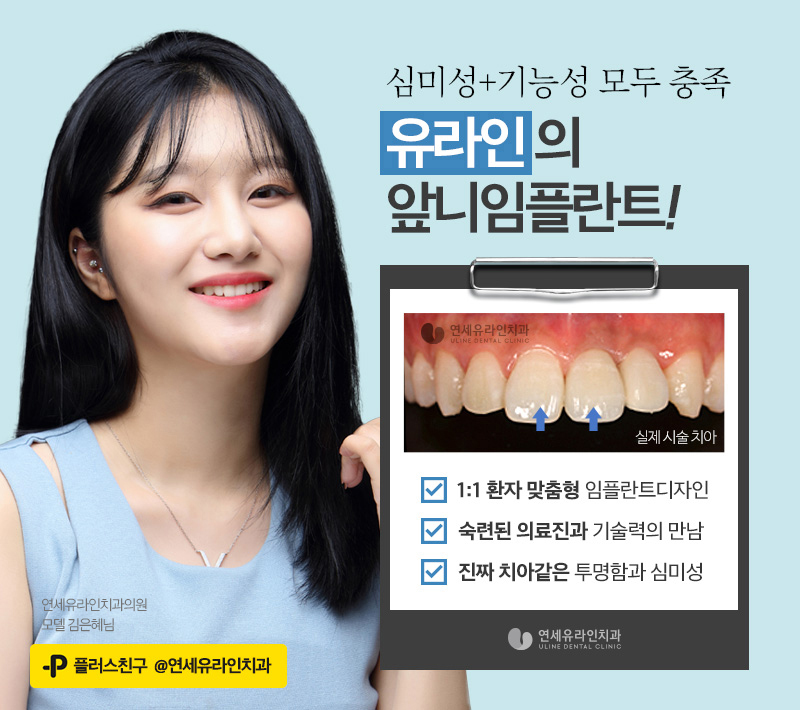앞니임플란트가격 시작부터 마음좋게 관련 이미지 6