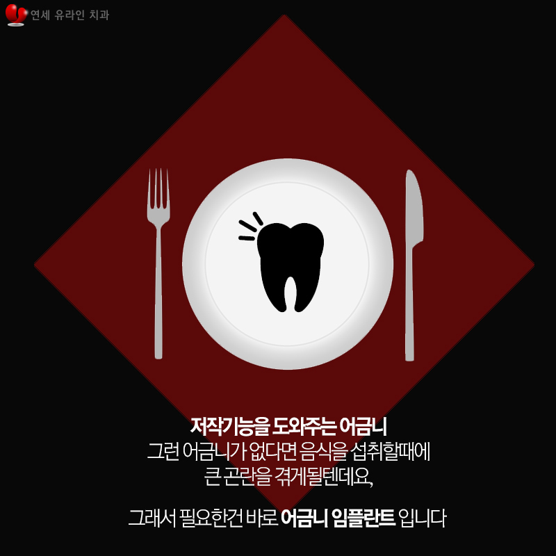 어금니임플란트가격 걱정을 내려줄 관련 이미지 2