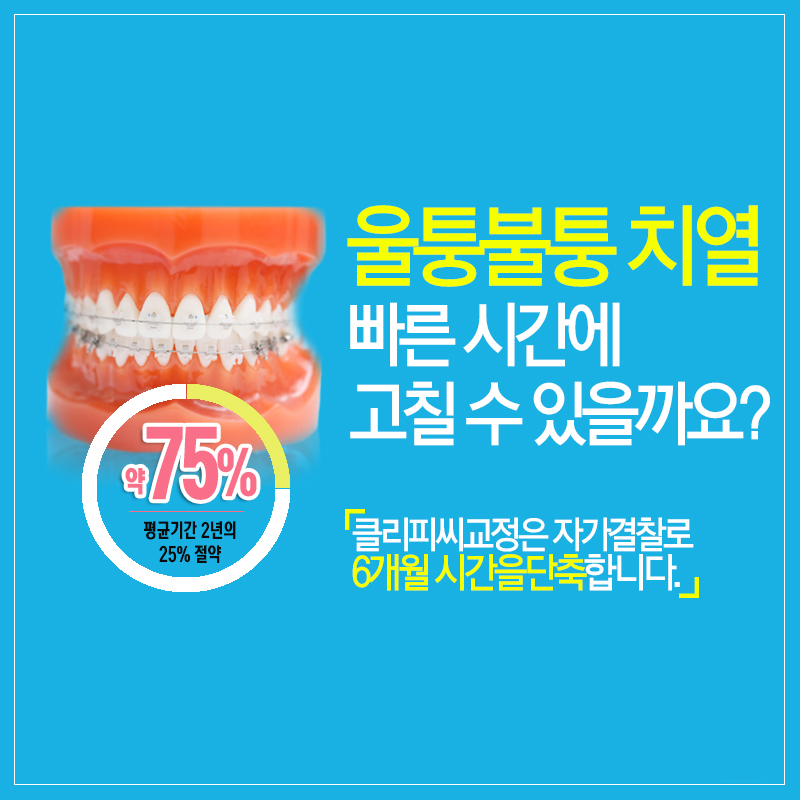 성인치아교정 고민하고계신가요? 관련 이미지 6