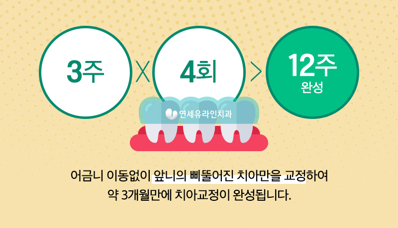 부분교정기간 열광하는이유 알겠네 관련 이미지 5