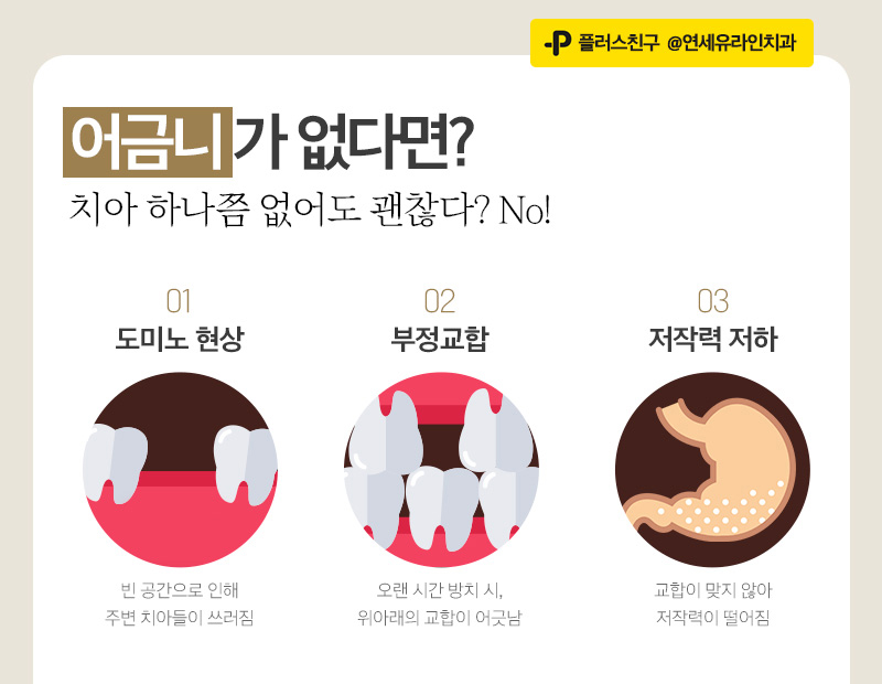 어금니임플란트가격에 대한 걱정되는마음을 관련 이미지 2
