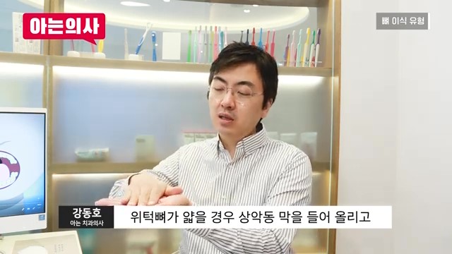 임플란트, 뼈이식 꼭 해야하는 케이스는? 관련 이미지 16