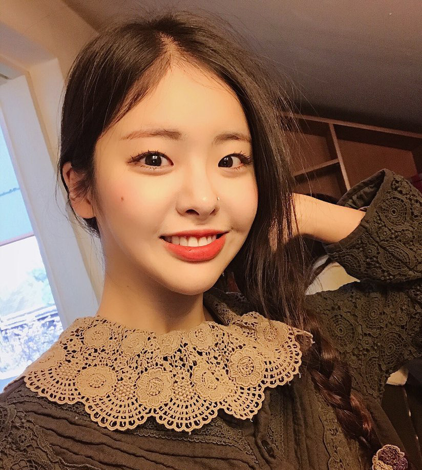 신림역치과, 치아교정 괜히 망설였네! 관련 이미지 3