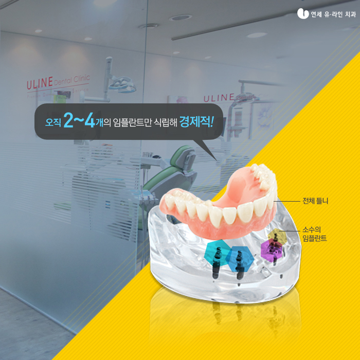 신림동치과 임플란트틀니비용 좋을수밖에! 관련 이미지 7