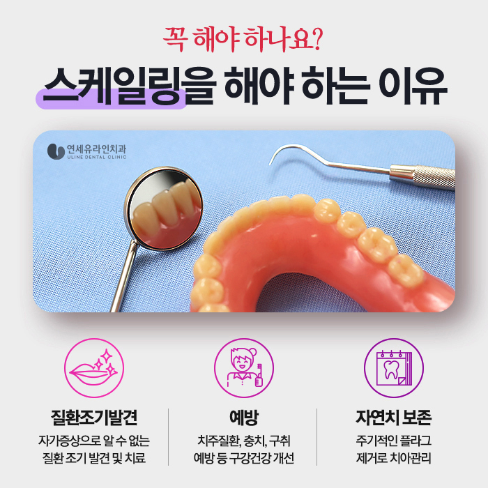 봉천동치과 스케일링 꼭 받는게 좋아요 관련 이미지 2
