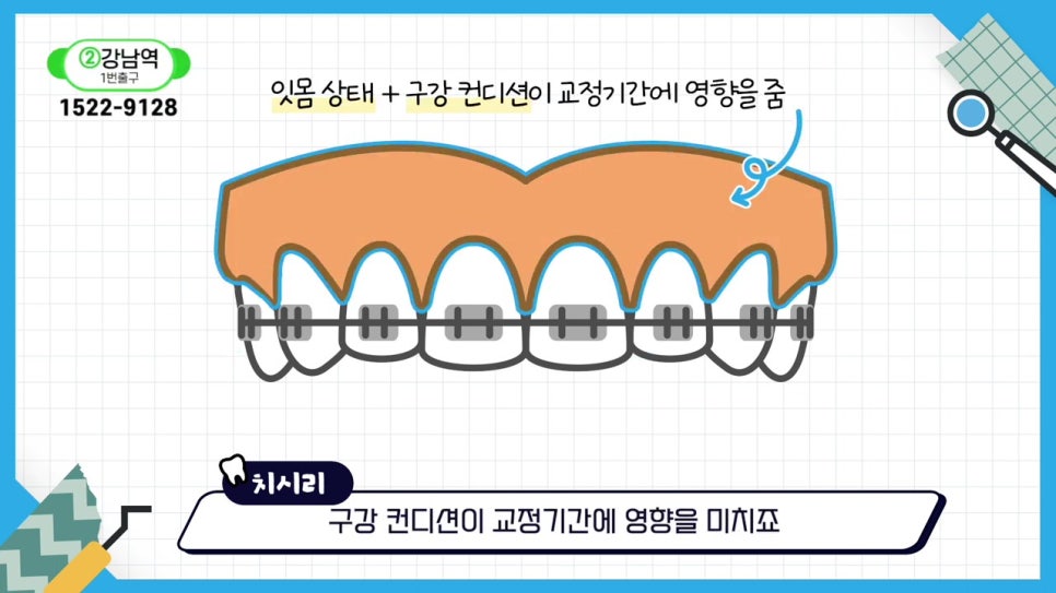 관악구치아교정, 빨리 끝내고 싶어? 관련 이미지 7