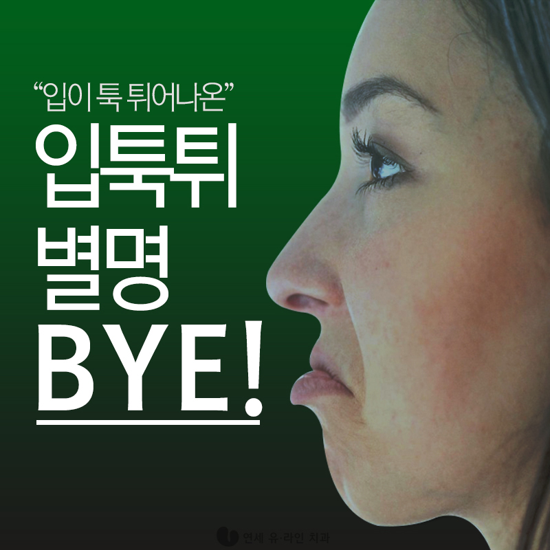 세라믹교정가격 이러니 인기만점 관련 이미지 1