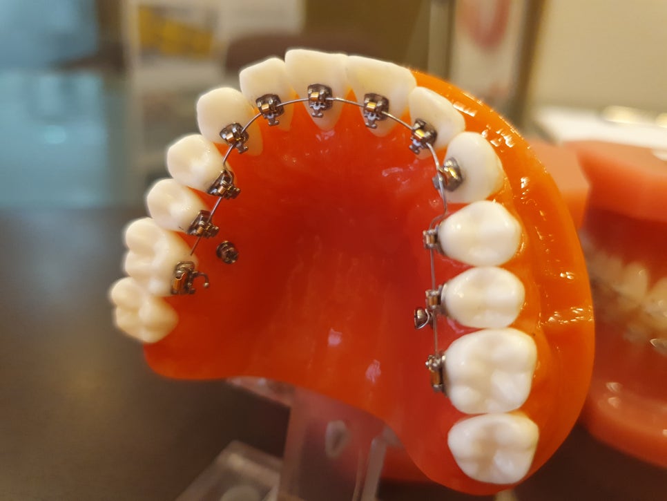 사당역치과 장점만 살려보면서 관련 이미지 3