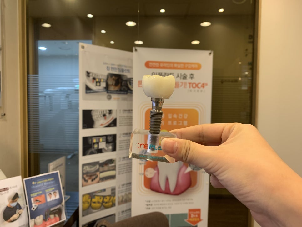 20대임플란트 오랜 사용감을 기대하죠 관련 이미지 3