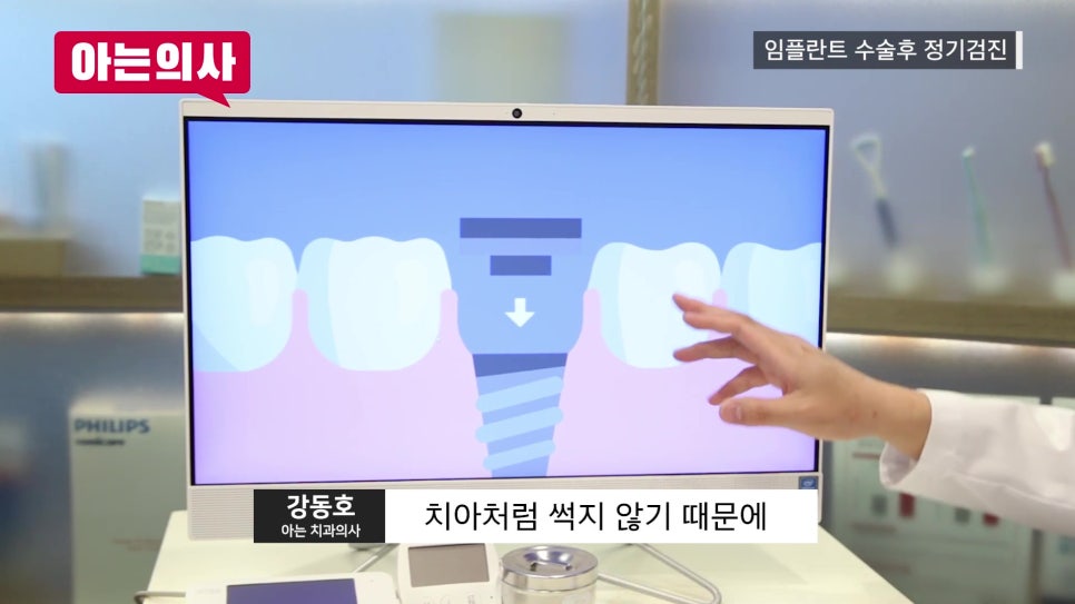 신림역임플란트 후, 정기검진 안 하면 관련 이미지 13