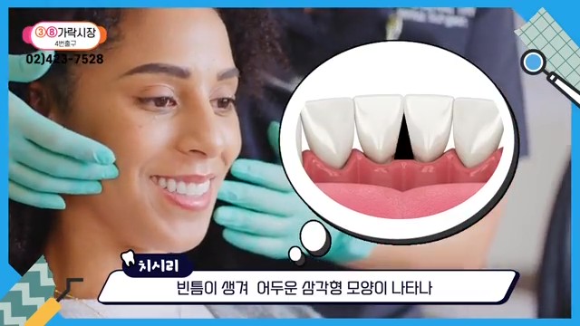 Can the Gaps Between Your Teeth That Make You Look Older Be Fixed? image 4