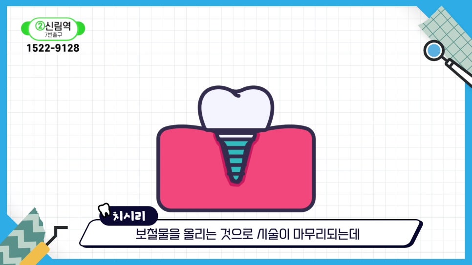 Sillim-dong Dental Clinic – Dentures vs. Implants: Which Should You Choose? image 19