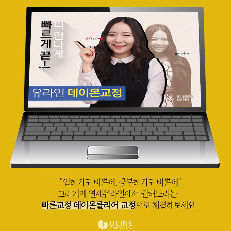 상도동치과 데이몬교정가격 뭐가걱정이야! 관련 이미지 6