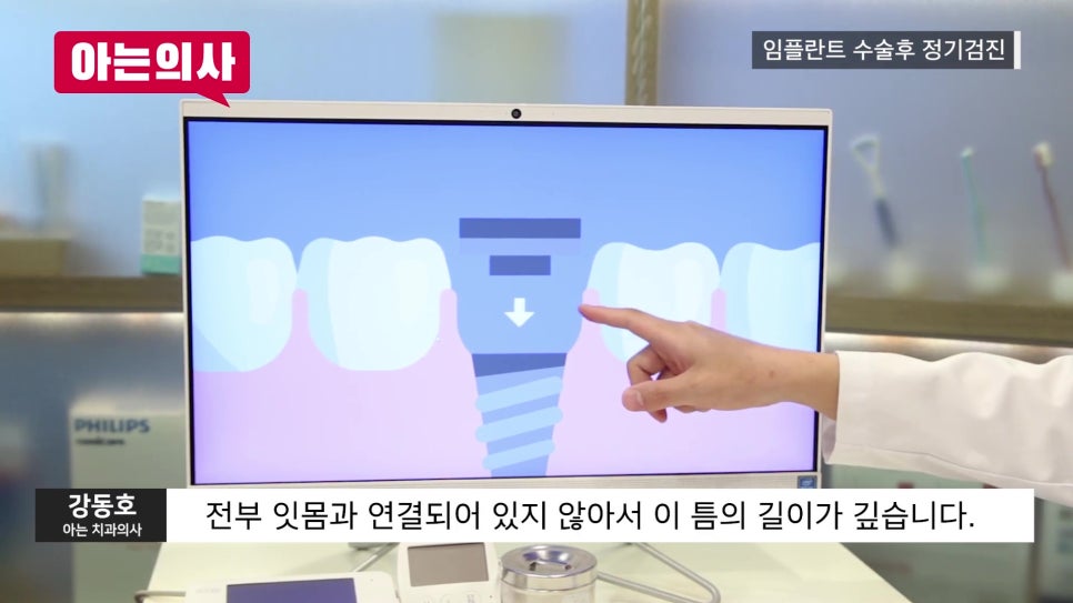 신림역임플란트 후, 정기검진 안 하면 관련 이미지 8