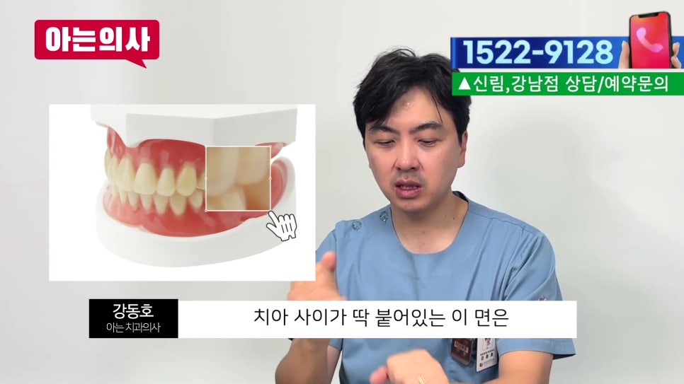 치실 안 쓰면 생기는 일 관련 이미지 5