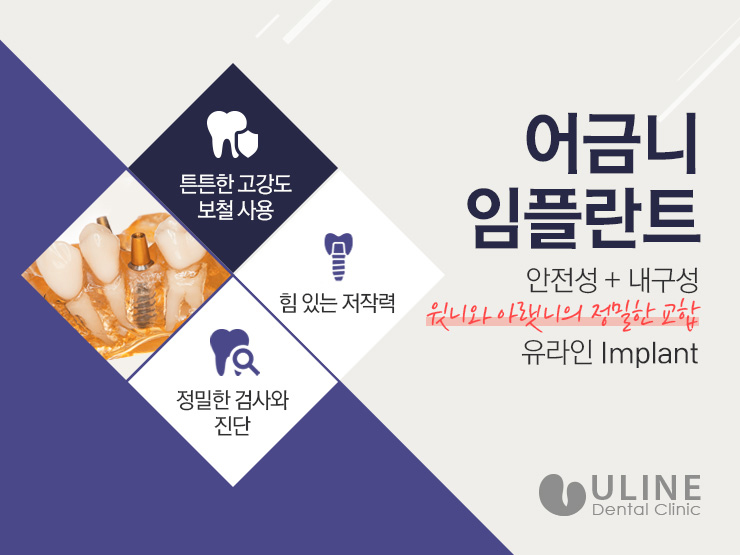 동작구치과 치아없는 불편함을 개선 관련 이미지 5