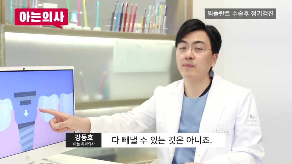 신림역임플란트 후, 정기검진 안 하면 관련 이미지 11