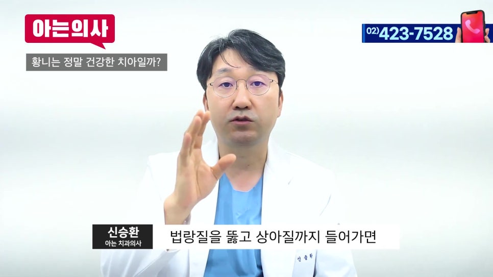 송파구치아미백, 연예인처럼 새하얗게 가능할까? 관련 이미지 22