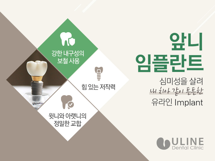 앞니임플란트잘하는곳 정말 중요하죠 관련 이미지 6