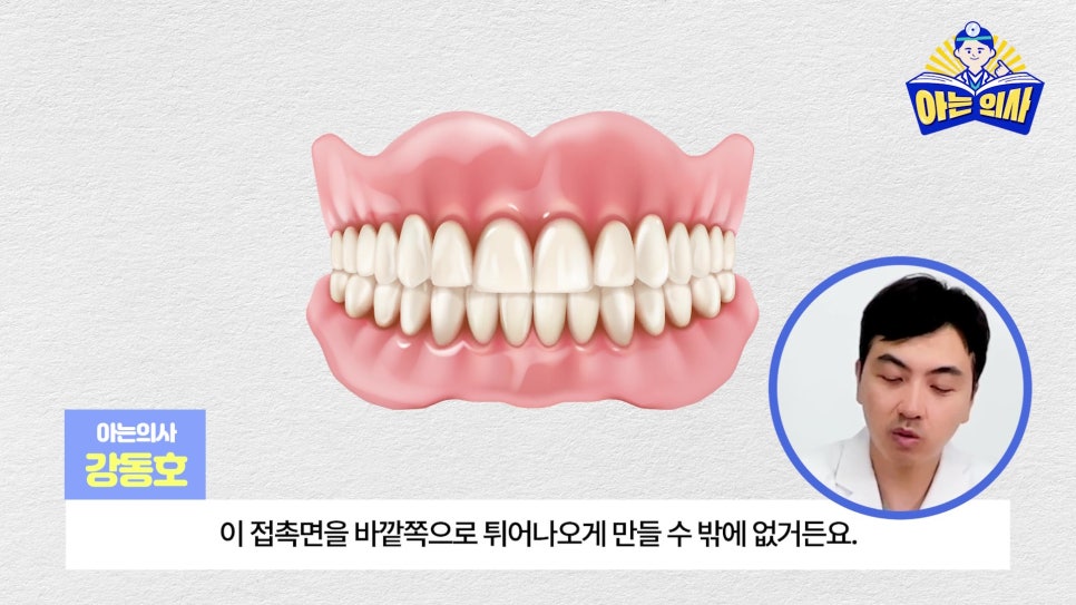 무삭제라미네이트, 단점 알고해야 관련 이미지 3