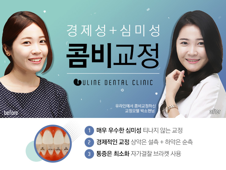 신림동치과 예쁜치아 만들기 시작 관련 이미지 7