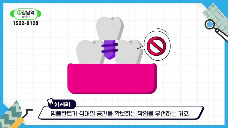 역삼동치과, 치아 빠진 뒤 빠르게 대처해야 하는 이유 관련 이미지 13