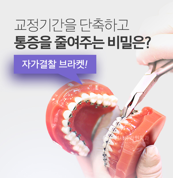 관악구치과 부분치아교정 빠를까? 관련 이미지 9