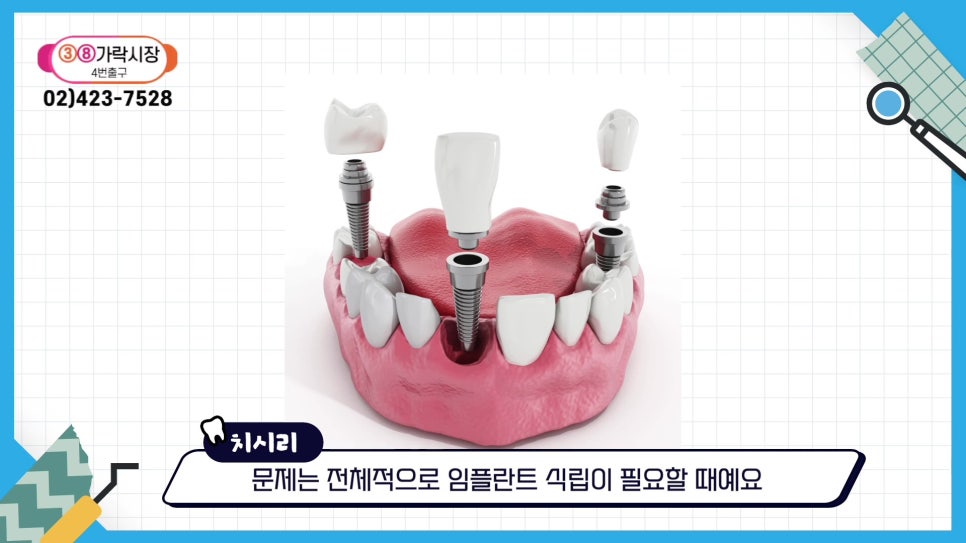 Sillim-dong Dental Clinic – Dentures vs. Implants: Which Should You Choose? image 20