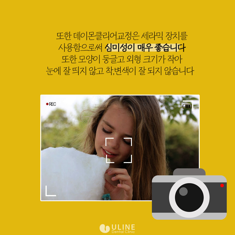 종합운동장역치과 정확한 결과가 중요하죠 관련 이미지 4