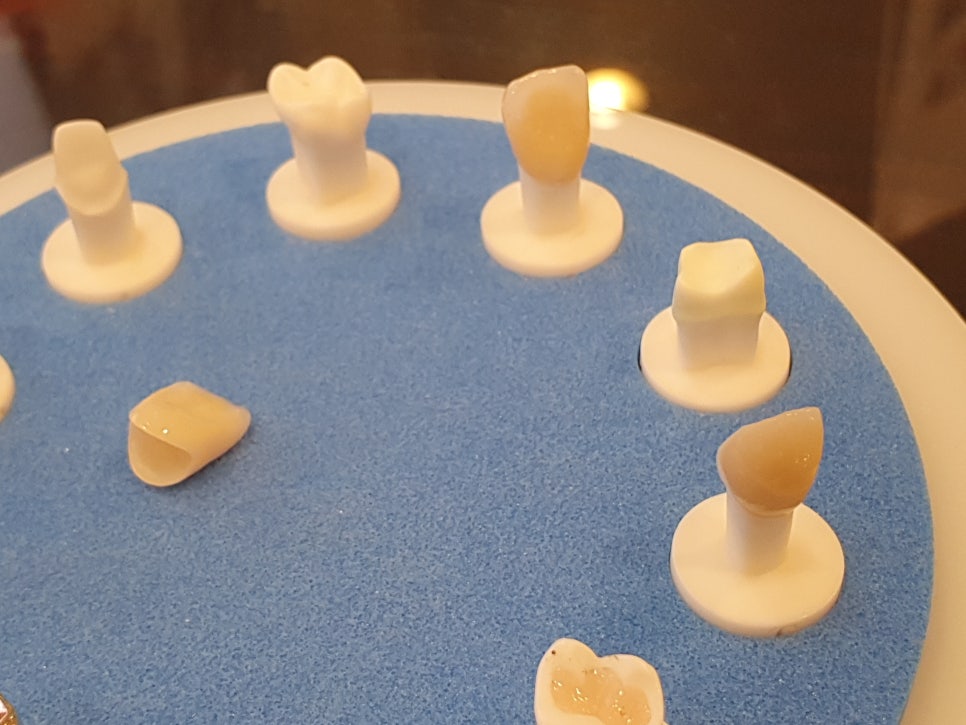 관악구 라미네이트 알고 진행하기 관련 이미지 5