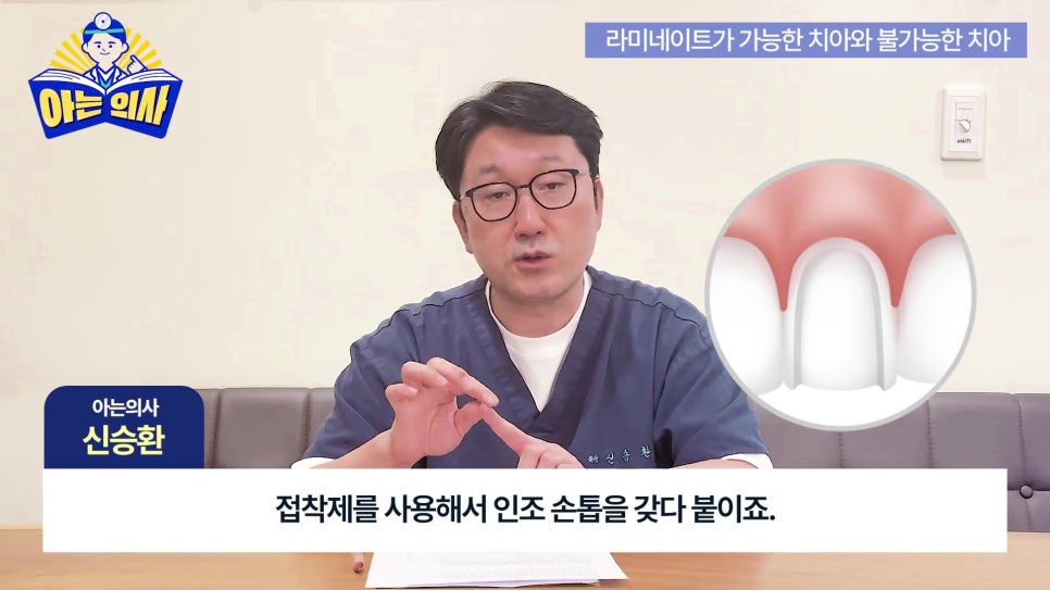 가락동치과 - 라미네이트가 불가능한 경우도 있어? 관련 이미지 4