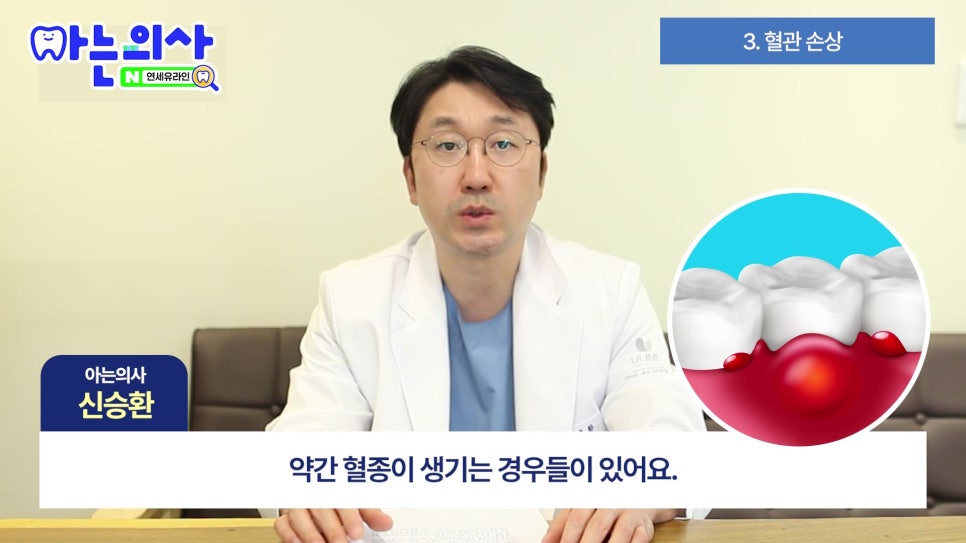 가락시장역치과 - 잇몸 왜 까매질까 관련 이미지 9