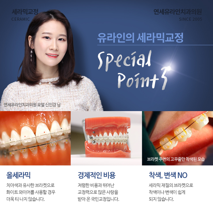 세라믹교정후기 오늘부터 시작할래 관련 이미지 6