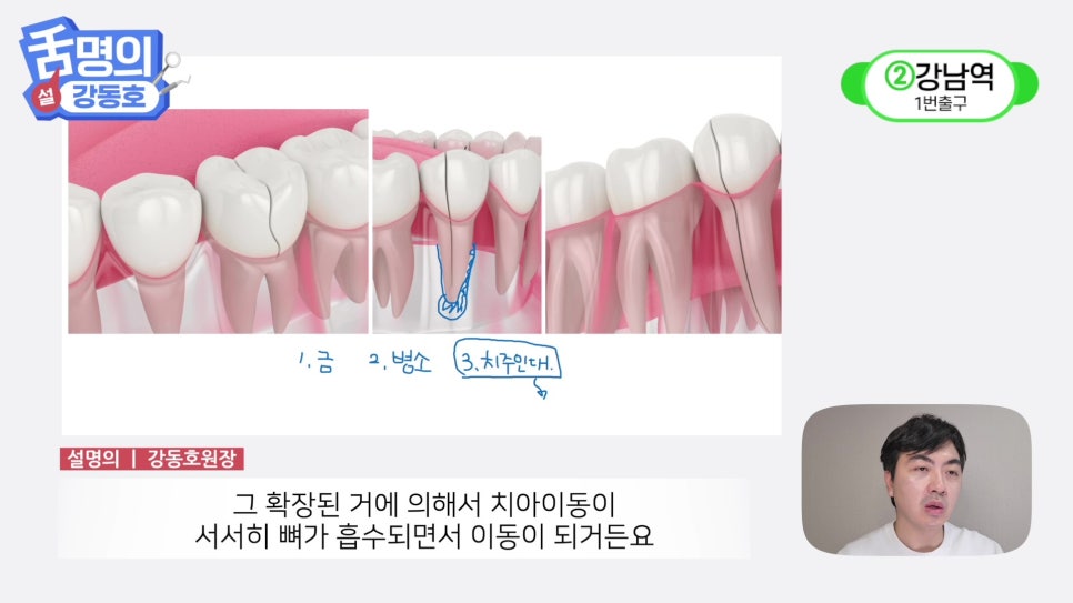 Sillim Station Dentist - Why Does It Hurt When Chewing? image 11
