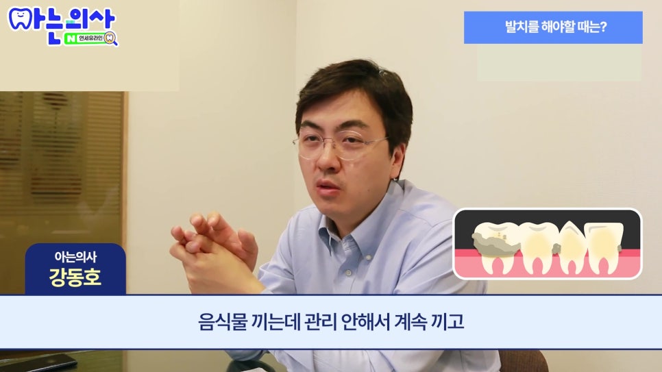 신림동치과 - 흔들리지 않는데 왜 발치하라고 할까? 관련 이미지 15