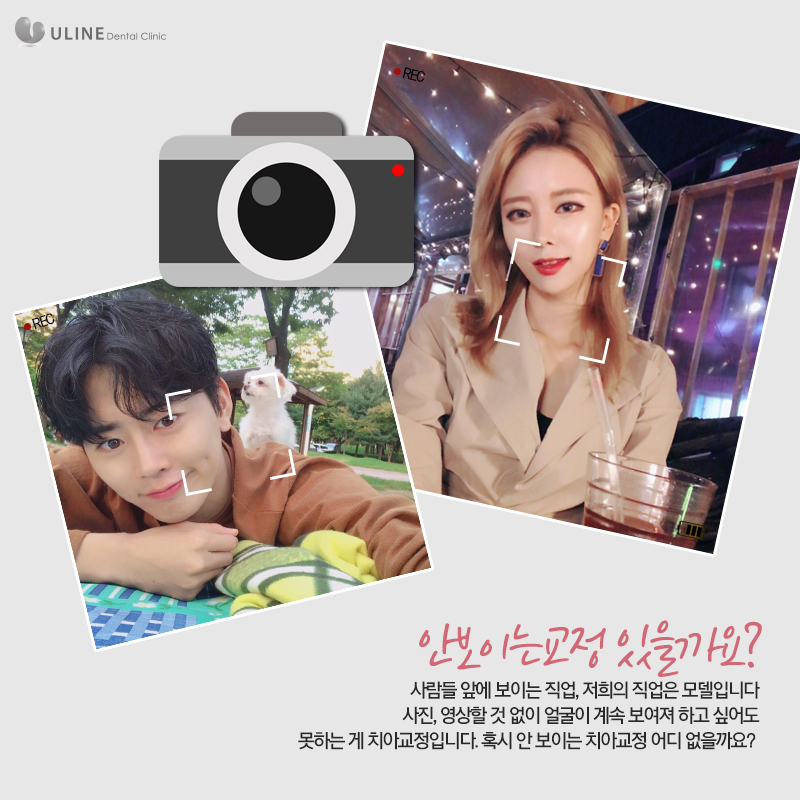 설측교정후기 반해버릴껄! 관련 이미지 2